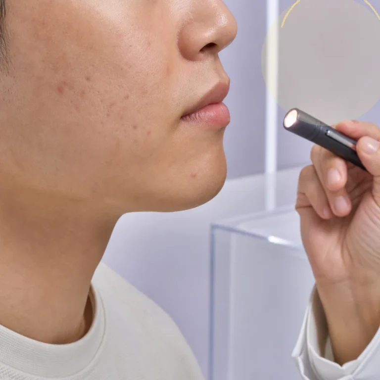 하남피부과 흉터와 통증 신호로 보는 여드름 상담 시점 | 하남피부과 정보 대표 이미지