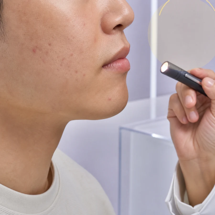 하남피부과 흉터와 통증 신호로 보는 여드름 상담 시점 | 하남피부과 정보 대표 이미지